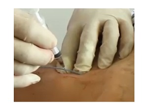 沅江市康胜实验用品有限公司,医学标本加工,免疫学切片,病原微生物学切片,解剖陈列标本 沅江市康胜实验用品有限公司,医学标本加工,免疫学切片,病原微生物学切片,解剖陈列标本